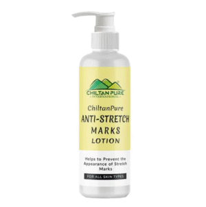 Anti Stretch Marks Lotion, 150ml - Chiltan Pure